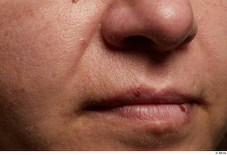 HD Face Skin Finley Newman cheek face lips mouth nose…